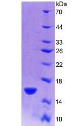 Rat RSPO1 / RSPO Protein (Recombinant His, N-Terminal)