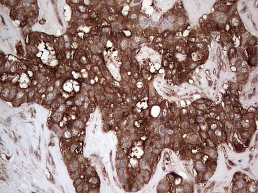 PKM2 Antibody (clone 12B9)