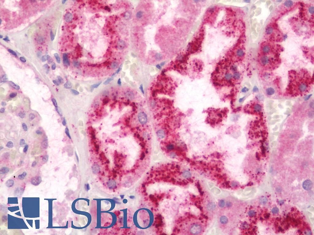 IHC-plus™ Polyclonal Rabbit anti-Human GABARAPL2 / ATG8 Antibody (IHC, IF, WB)