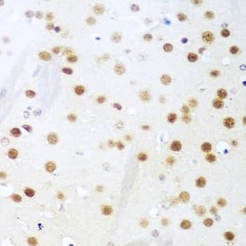 UNG / Uracil DNA Glycosylase Antibody