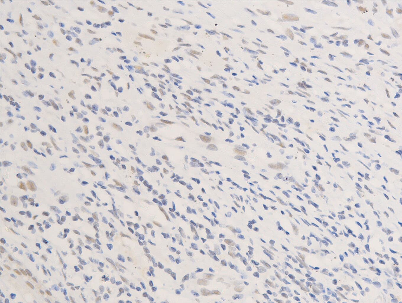 EGFR Antibody (phospho-Ser1026)