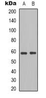 Polyclonal Rabbit anti-Human BLK Antibody (C-Terminus, IHC, WB)
