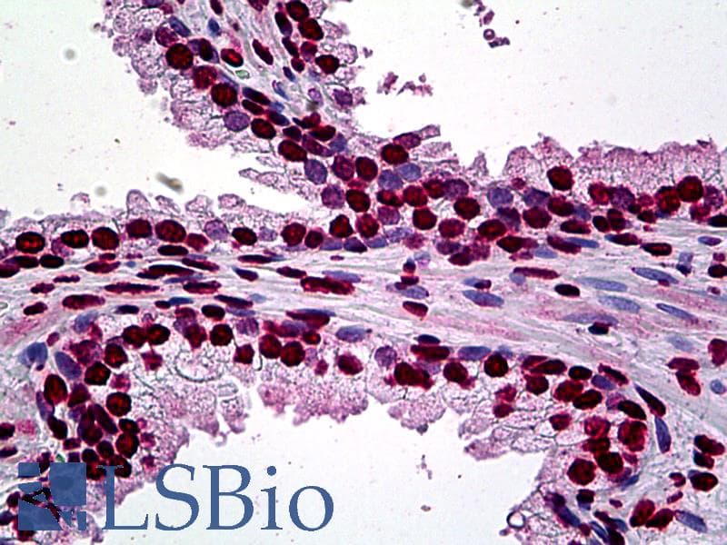 IHC-plus™ ATF1 Antibody (clone 3E7)