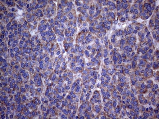 DJ858B16.2 / PISD Antibody (aa80-340, clone OTI6C3)