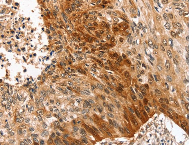 SYNPO2 / Synaptopodin 2 Antibody