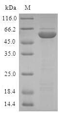 Human ABH2 / ALKBH2 Protein (Recombinant GST, N-terminus)