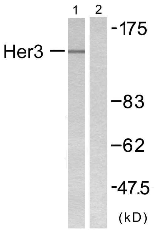 Polyclonal Rabbit anti-Human ERBB3 / HER3 Antibody (IHC, WB)