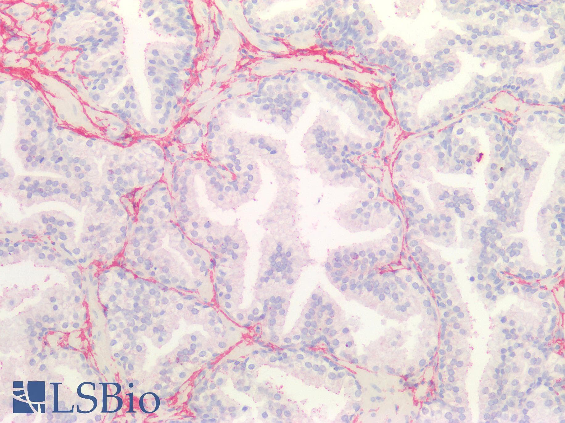 PathPlus™ COL3A1 / Collagen III Antibody