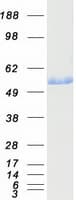 Human ALDH3A1 Protein (Recombinant Myc-DDK (Flag))