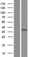 Human TSSK4 / TSSK5 Protein (Over-Expression Lysate Myc-DDK (Flag))
