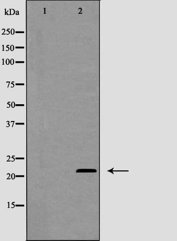 MGMT Antibody