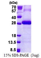Human PRSS3 / Trypsin 3 Protein (Recombinant His)