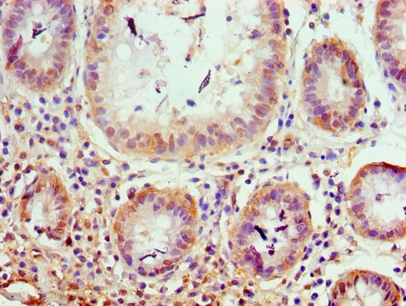 TRIM27 Antibody (aa214-513)