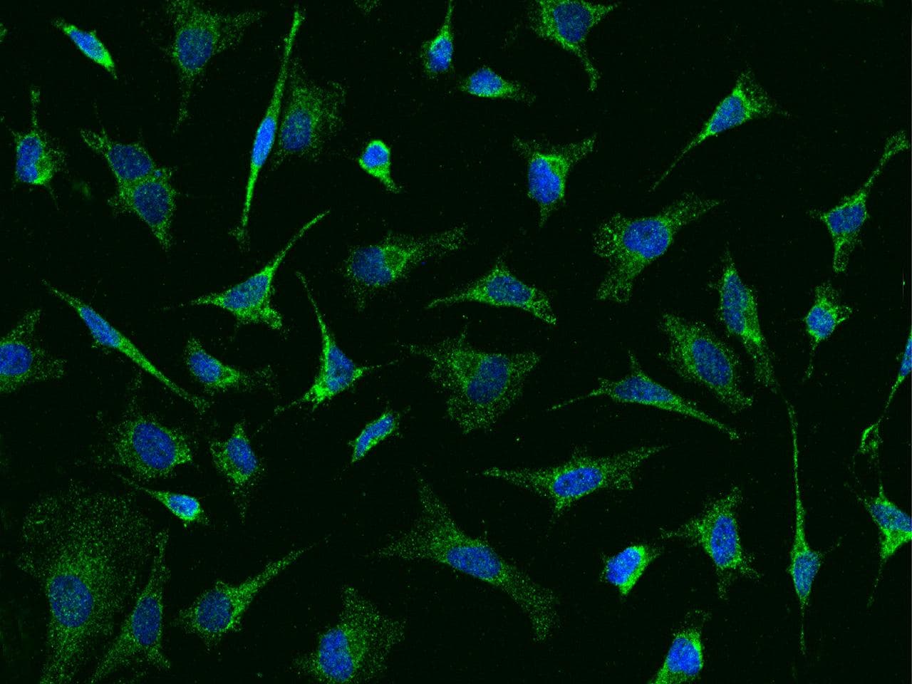 BCKDHA / BCKDE1A Antibody