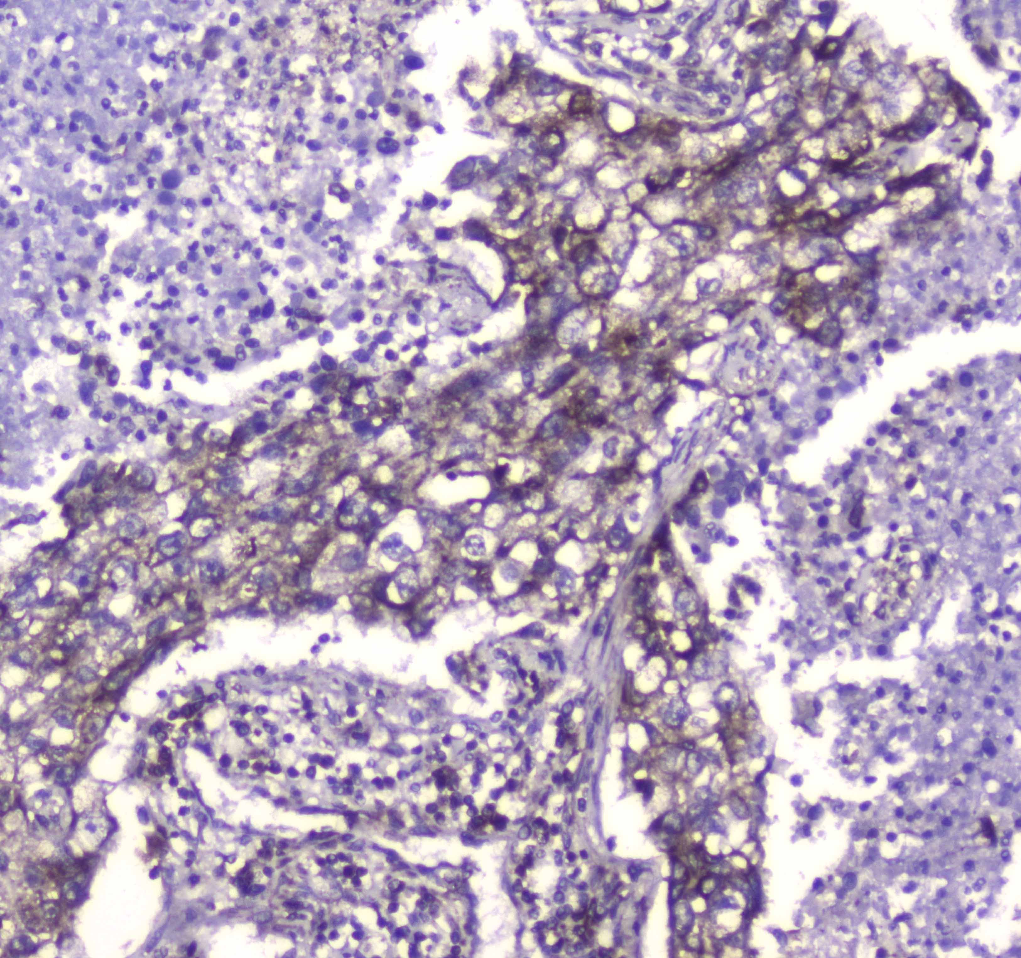 CLPP Antibody