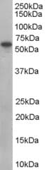 Polyclonal Goat anti-Human SNX9 / WISP Antibody (aa510-522, WB)