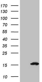 S100A5 Antibody (clone OTI4C9)