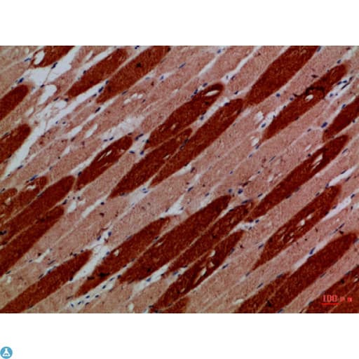 KDM3A / JMJD1A Antibody