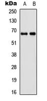 DDX55 Antibody (Internal)