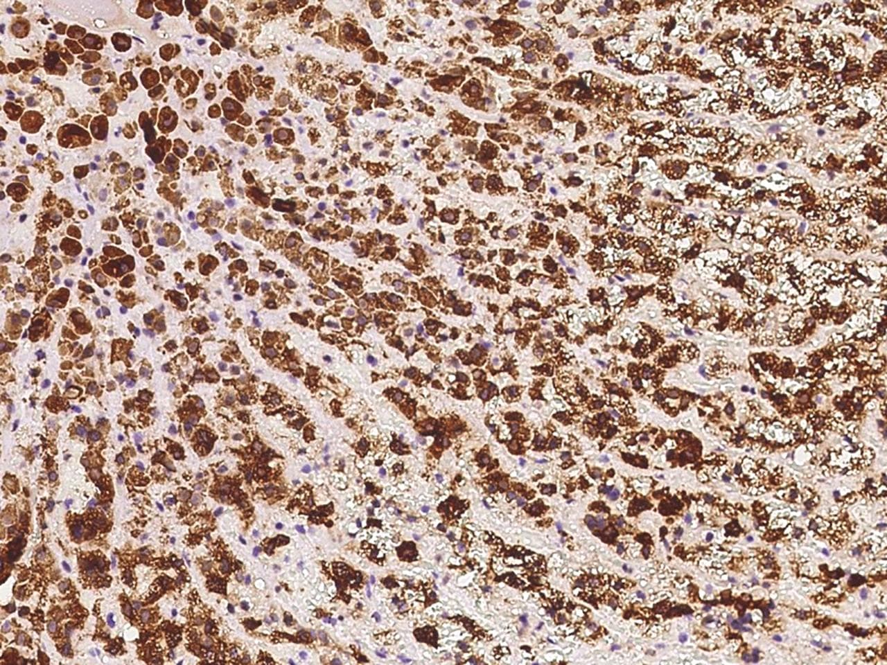 DHCR24 / Seladin-1 Antibody