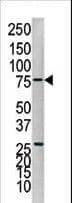 PTP1B Antibody (aa23-53)