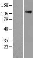 RASA1 Protein (Over-Expression Lysate Myc-DDK (Flag))