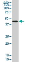 NDRG2 Antibody (clone 1D12)