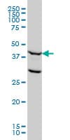 FEN1 Antibody (clone 1E2)
