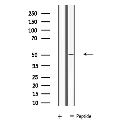 Polyclonal Rabbit anti-Human LRP11 Antibody (IF, WB)