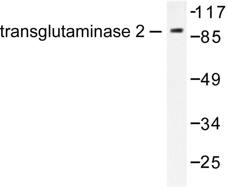 Polyclonal Rabbit anti-Human TGM2 / Transglutaminase 2 Antibody (Asp11, IHC, WB)