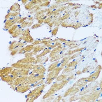 Polyclonal Rabbit anti-Human ARHGEF5 Antibody (IHC)