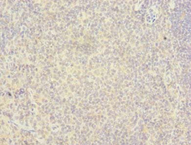 Polyclonal Rabbit anti-Human RAB6B Antibody (IHC, WB)