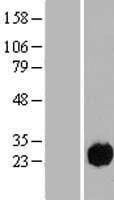 Human C15orf57 / CCDC32 Protein (Over-Expression Lysate Myc-DDK (Flag))