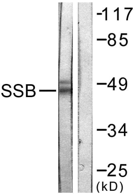 SSB / La Antibody (p366)