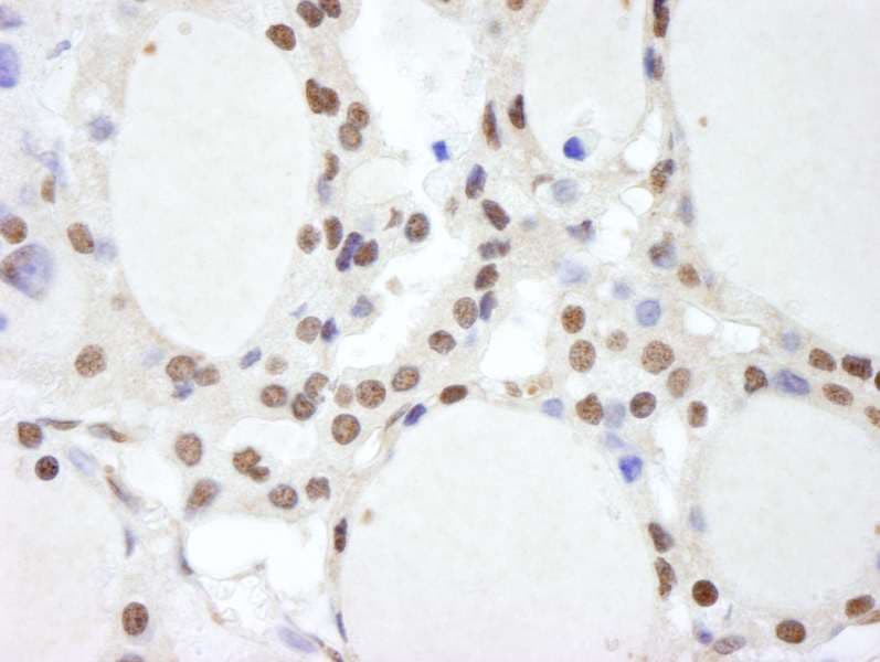 Polyclonal Rabbit anti-Human COPS2 / TRIP15 / ALIEN Antibody (aa1-50, IHC)
