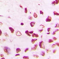 Polyclonal Rabbit anti-Human CUL1 / Cullin 1 Antibody (C-Terminus, IHC, IF, WB)