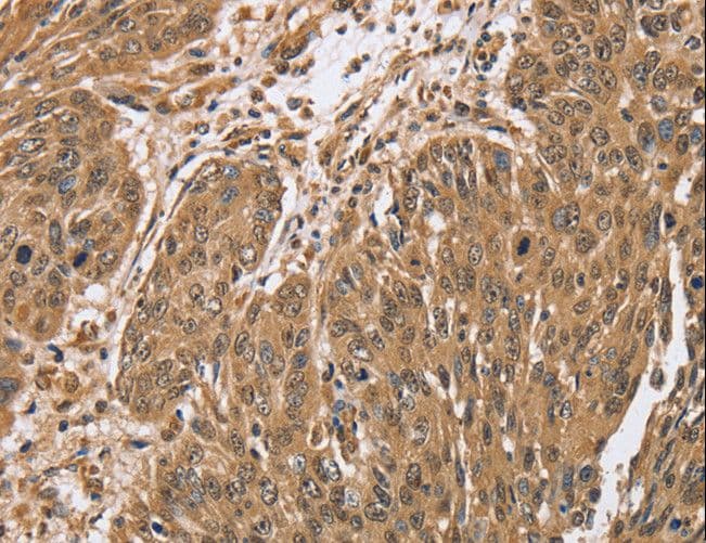 Polyclonal Rabbit anti-Human PTPN20 Antibody (IHC)