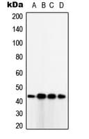 IHC-plus™ Polyclonal Rabbit anti-Human TUSC3 Antibody (Internal, IHC, IF, WB)