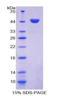 Mouse CAV1 / Caveolin 1 Protein (Recombinant His-GST)
