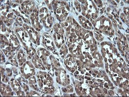 TRMT2A Antibody (clone OTI3B3)