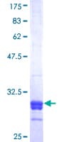 Human SRD5A2 Protein (Recombinant GST, N-terminus)