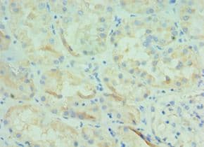 Polyclonal Rabbit anti-Human BOC Antibody (aa1-125, IHC)