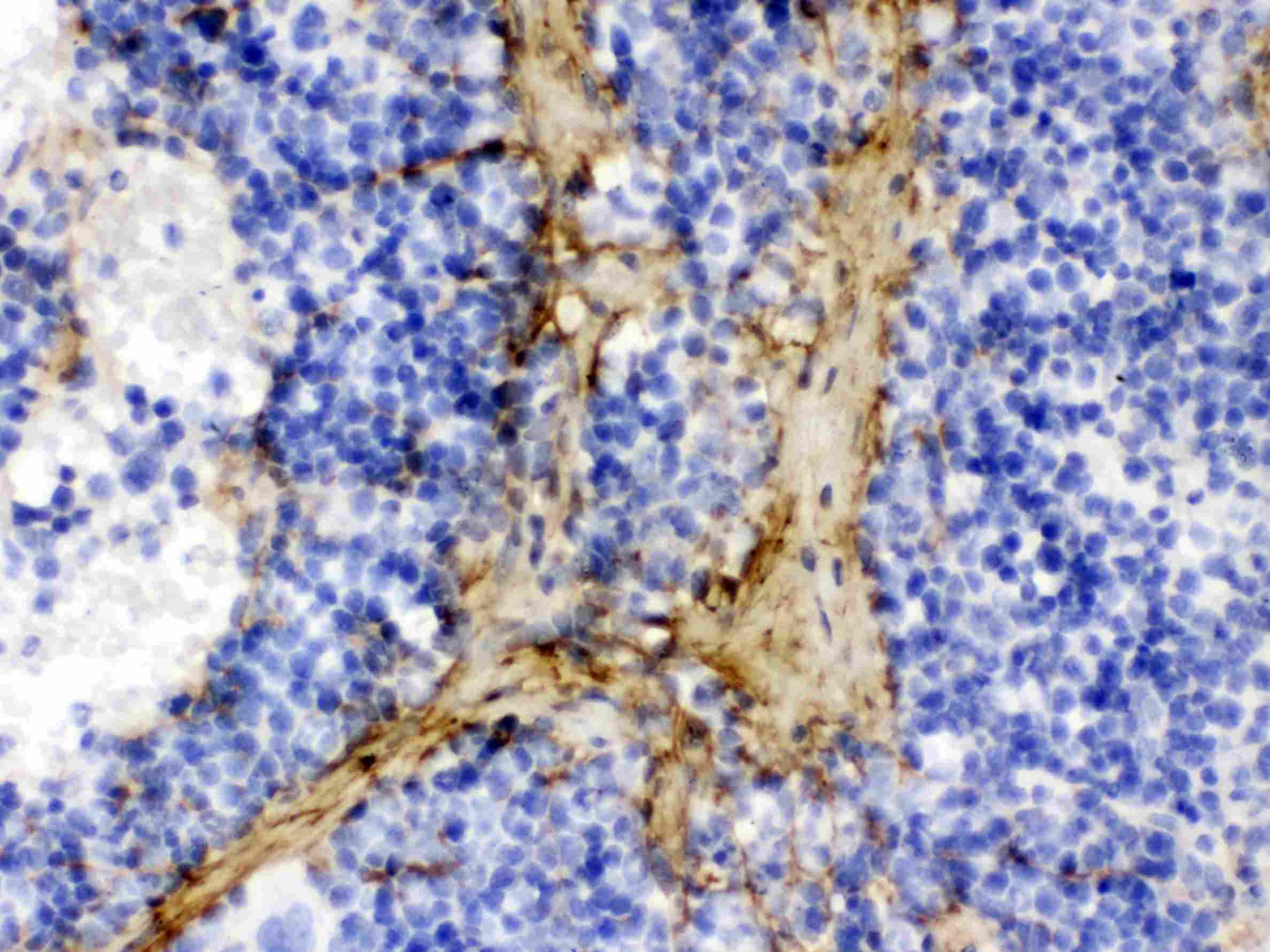 COL1A1 / Collagen I Alpha 1 Antibody (aa1185-1207)