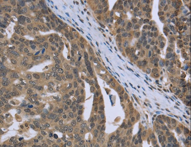 PTK2B / PYK2 Antibody