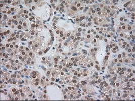 BUB1B / BubR1 Antibody (clone OTI3C7)