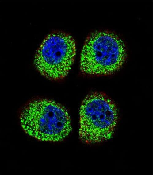 Polyclonal Rabbit anti-Human ARRB1 / Beta Arrestin 1 Antibody (aa336-363, IHC, IF, WB)