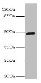 Polyclonal Rabbit anti-Human ILT3 / LILRB4 Antibody (WB)
