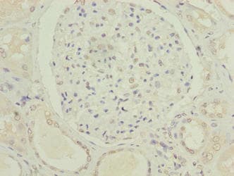 C5orf24 Antibody