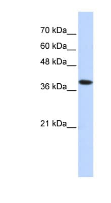 ATP4B Antibody (aa215-264)
