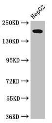 Polyclonal Rabbit anti-Human RAI1 Antibody (IHC, IF, WB)